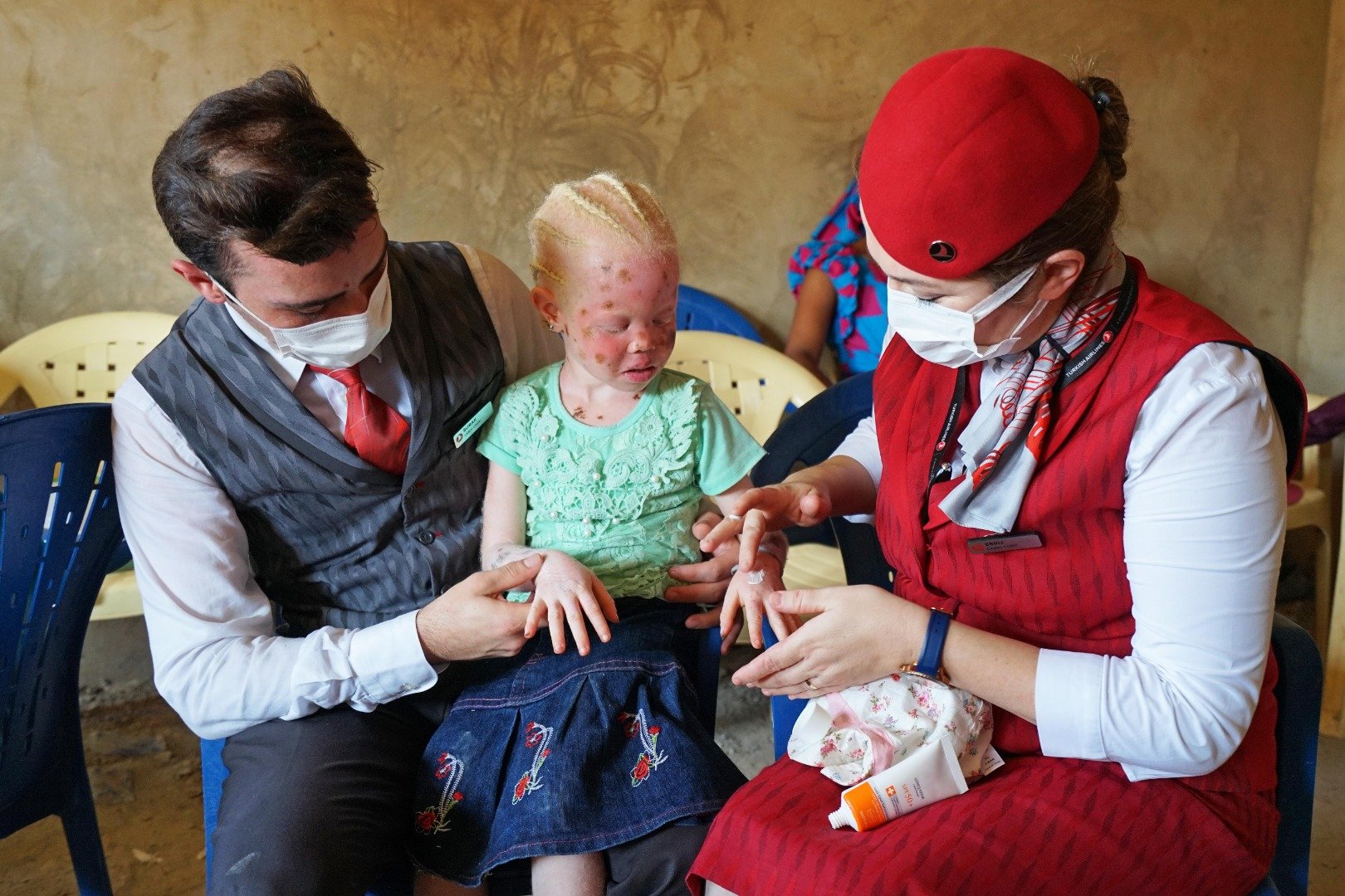 THY,  albino hastası çocukların yaralarına merhem oldu 