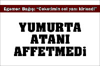 Ceketinin Sol Yanı Kirlenmiş...