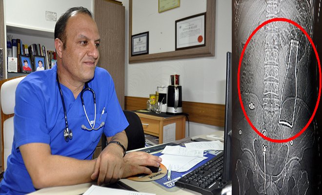 Hastanede, vücudunda şişe olduğu ortaya çıktı