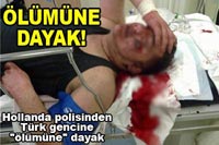 Hollanda Polisi Türk Gencini Öldüresiye Dövdü.