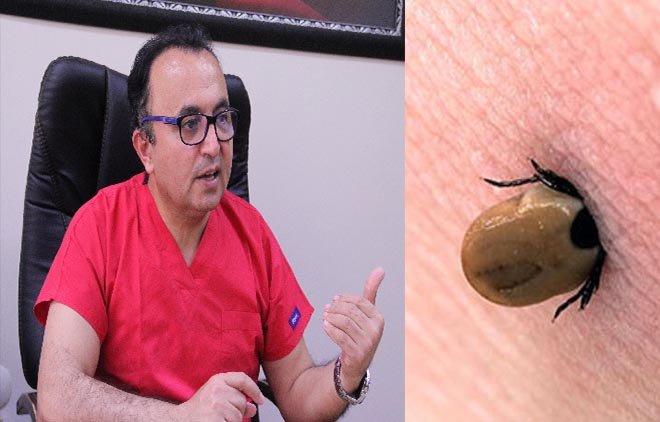 Prof. Dr. Yıldız:  Kene saç içinde görülebiliyor
